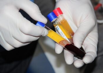 Benefits of using Dr. R. Akhmerov’s PRP tube: what are they need for