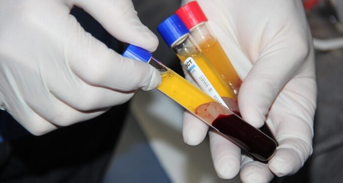 Benefits of using Dr. R. Akhmerov’s PRP tube: what are they need for